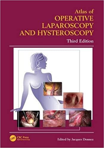 indir Atlas of Operative Laparoscopy and Hysteroscopy (Encyclopedia of Visual Medicine Series)