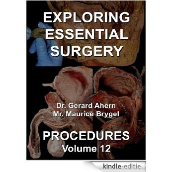 Exploring Essential Surgery: Procedures (English Edition) [Kindle-editie]