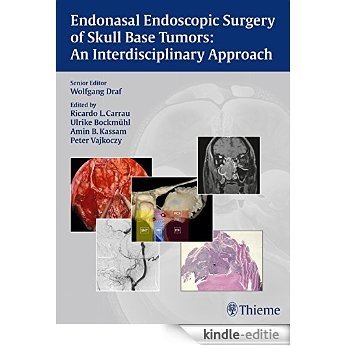 Endonasal Endoscopic Surgery of Skull Base Tumors: An Interdisciplinary Approach [Kindle-editie]