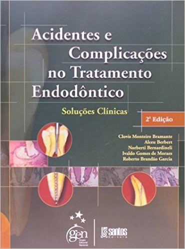 Acidentes E Complicações No Trat. Endodontico Soluções Clinicas