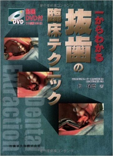 一からわかる抜歯の臨床テクニック―動画DVD付