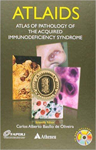 Atlaids - Atlas De Patologia Da Sindrome De Imunodeficiencia Adquirida