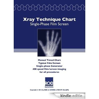 Xray Technique Chart Single-Phase Film Screen (English Edition) [Kindle-editie]