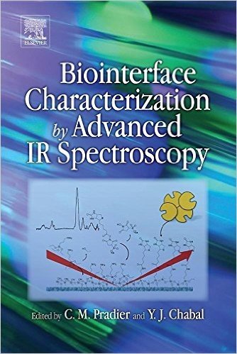 Biointerface Characterization by Advanced IR Spectroscopy