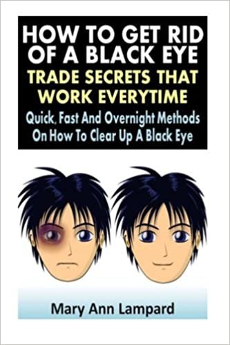 How To Get Rid Of A Black Eye : Trade Secrets That Work Everytime: Quick, Fast And Overnight Methods On How To Clear Up A Black Eye