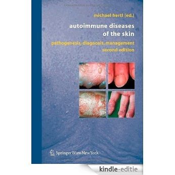 Autoimmune Diseases of the Skin: Pathogenesis, Diagnosis, Management [Kindle-editie]