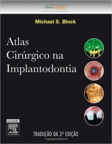 Atlas Cirúrgico na Implantodontia