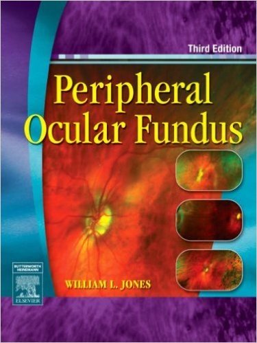 Peripheral Ocular Fundus