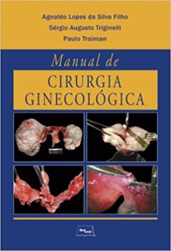 Manual de Cirurgia Ginecológica