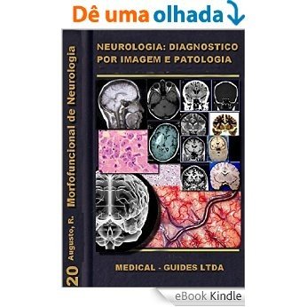 Neurologia: Diagnóstico por Imagem (Guias médicos Livro 2) [eBook Kindle]