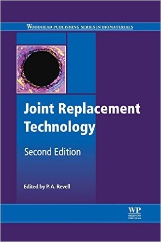Joint Replacement Technology baixar