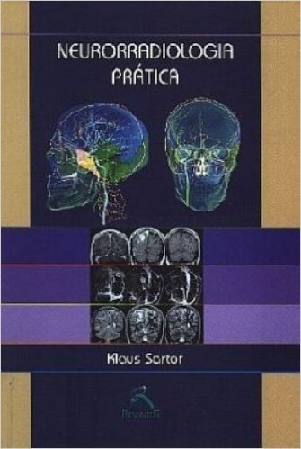 Neurorradiologia Prática