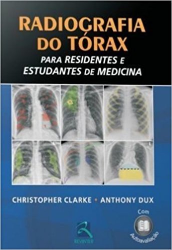 Radiografia Do Torax. Para Residentes E Estudantes De Medicina