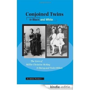 Conjoined Twins in Black and White: The Lives of Millie-Christine McKoy and Daisy and Violet Hilton (Wisconsin Studies in Autobiography) [Kindle-editie]