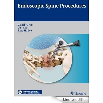 Endoscopic Spine Procedures [Kindle-editie]