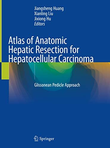 Atlas of Anatomic Hepatic Resection for Hepatocellular Carcinoma : Glissonean Pedicle Approach (English Edition)