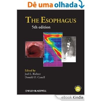 The Esophagus [eBook Kindle]