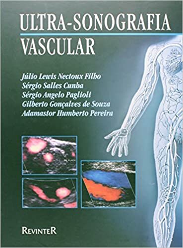 Ultra-Sonografia Vascular