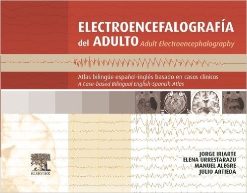 Electroencefalografía del adulto: Atlas bilingüe español-inglés basado en casos clínicos