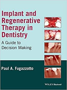 indir Implant and Regenerative Therapy in Dentistry: A Guide to Decision Making
