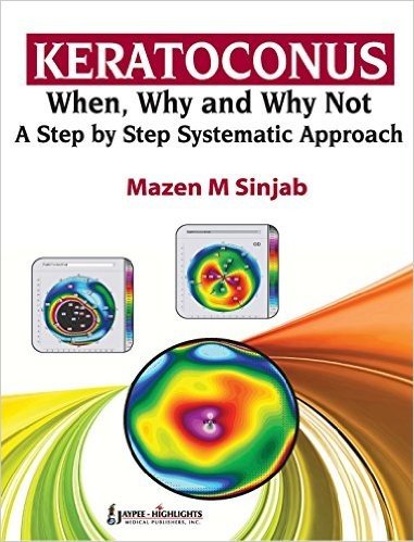 Keratoconus: When, Why and Why Not-A Step-by-Step Systematic Approach: A Step by Step Systematic Approach