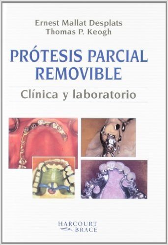 Protesis Parcial Removiable Colada: Clinica y Laboratorio