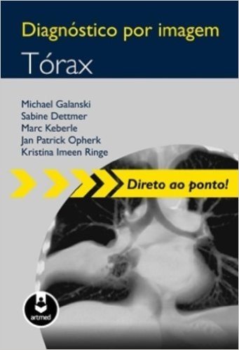 Diagnóstico por Imagem. Tórax