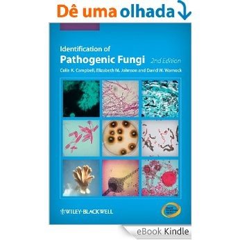 Identification of Pathogenic Fungi [eBook Kindle]