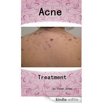 Acne Treatment (How to...) (English Edition) [Kindle-editie] beoordelingen
