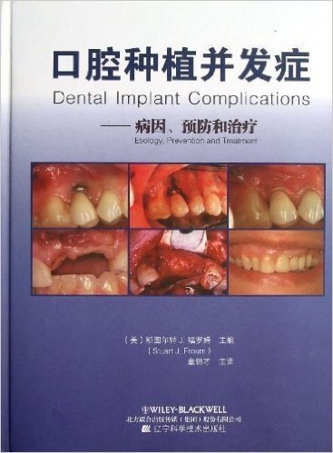 口腔种植并发症--病因预防和治疗(精)