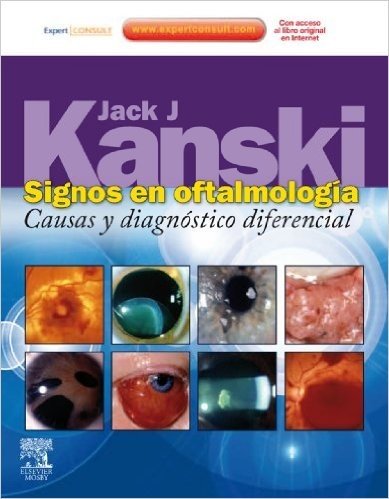 Signos en oftalmología + ExpertConsult: Causas y diagnóstico diferencial
