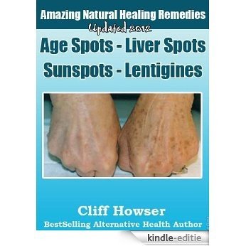 Amazing Natural Healing Remedies - Age Spots - Liver Spots - Sunspots - Lentigines (English Edition) [Kindle-editie]