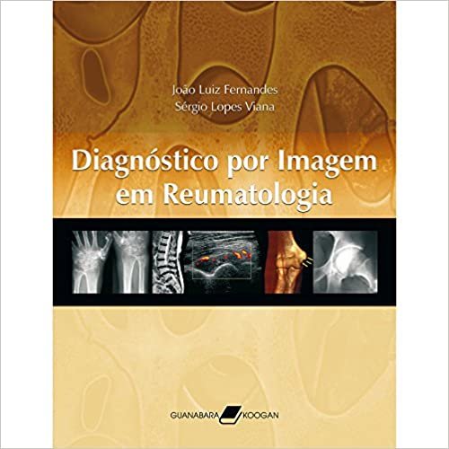 Diagnostico Por Imagem Em Reumatologia