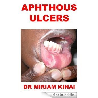 Dermatology: Aphthous Ulcers (Skin Diseases Book 38) (English Edition) [Kindle-editie]