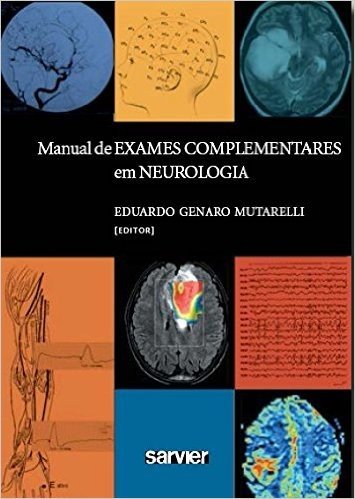 Manual De Exames Complementares Em Neurologia