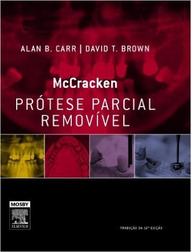 McCracken Prótese Parcial Removível