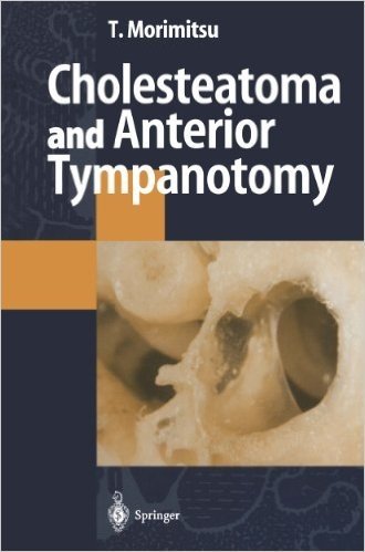 Cholesteatoma and Anterior Tympanotomy baixar