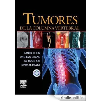 Tumores de la columna vertebral [Kindle-editie]