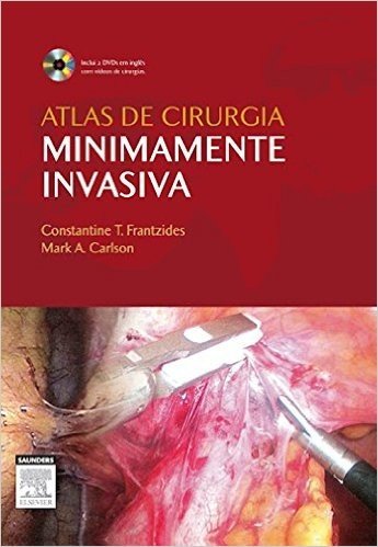 Atlas de Cirurgia Minimamente Invasiva 1ª Edição