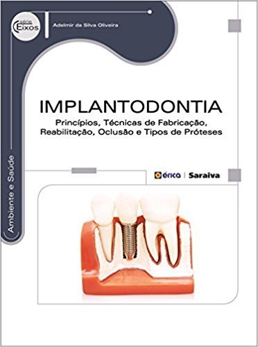 Implantodontia. Princípios, Técnicas de Fabricação, Reabilitação, Oclusão e Tipos de Próteses baixar