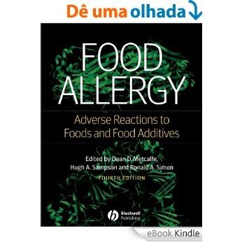 Food Allergy: Adverse Reactions to Foods and Food Additives [eBook Kindle]