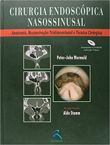 Cirurgia Endoscopica Nasossinusal Anatomia. Reconstrução Tridimensiona