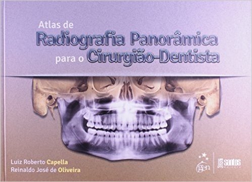 Atlas De Radiografia Panoramica Para O Cirurgiao-Dentista