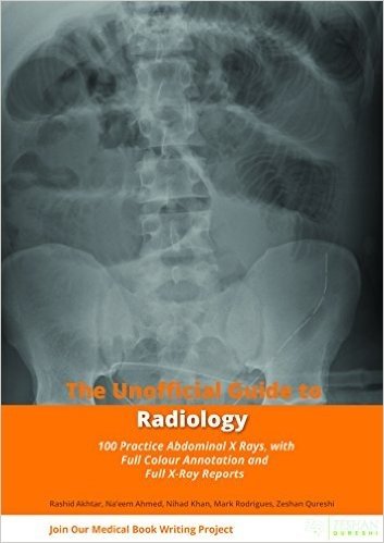 The Unofficial Guide to Radiology: 100 Practice Abdominal X Rays with Full Colour Annotations and Full X Ray Reports