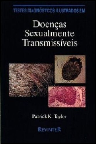 Testes Diagnosticos Ilustrados Em Doenças Sexualmente Transmissiveis