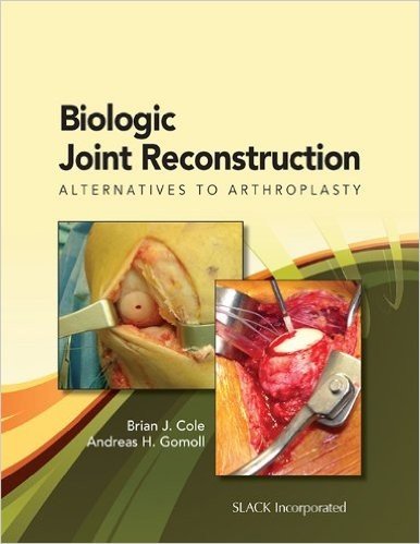 Biologic Joint Reconstruction: Alternatives to Joint Arthroplasty baixar