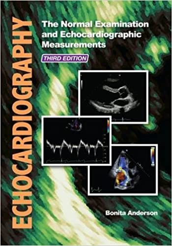 indir Echocardiography: The Normal Examination and Echocardiographic Measurements