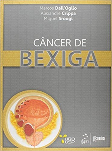 Cancer De Bexiga