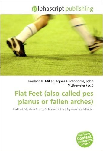 Flat Feet (Also Called Pes Planus or Fallen Arches)