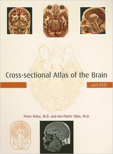 Cross-Sectional Atlas of the Brain